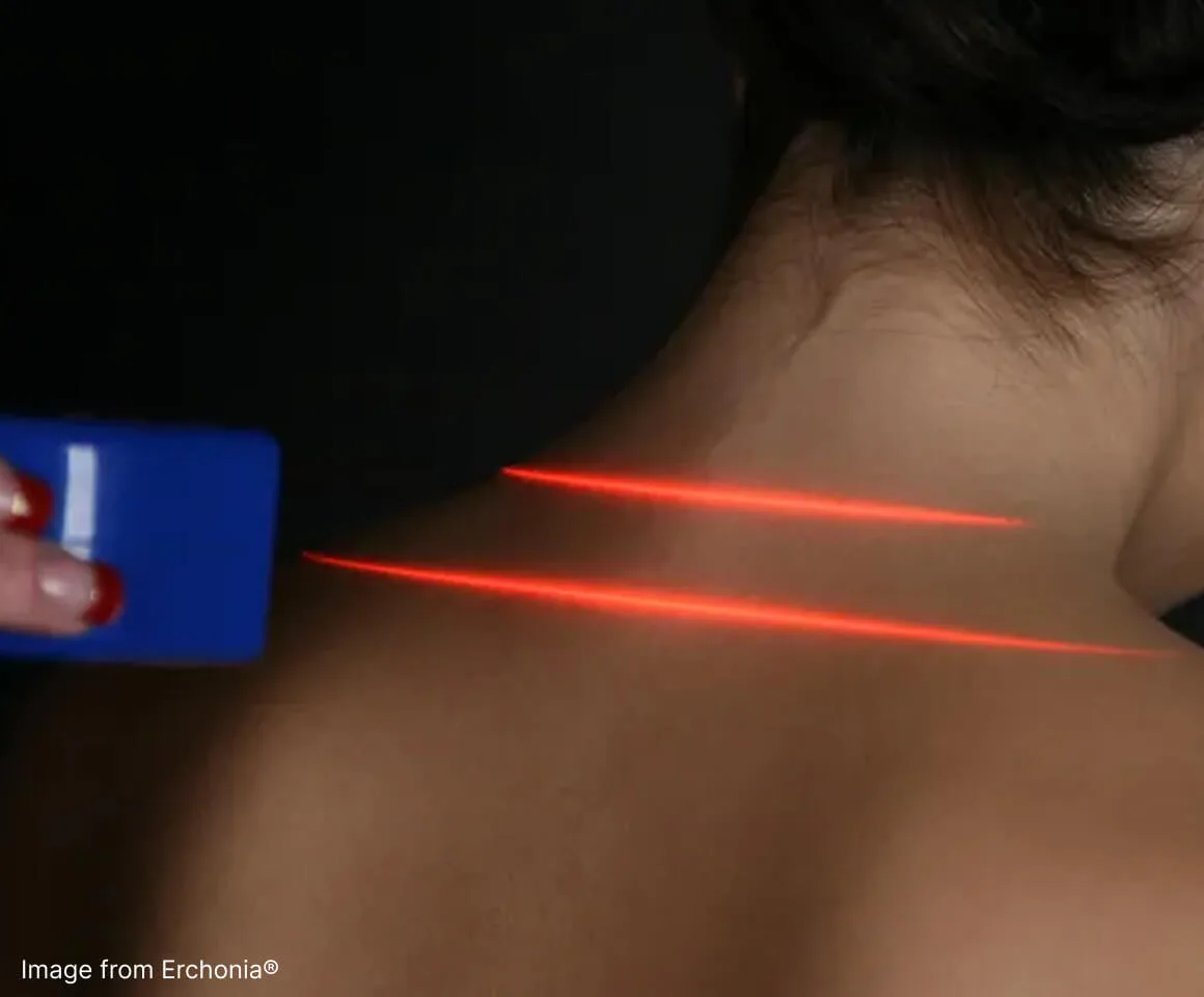 Erchonia Laser Light Therapy?