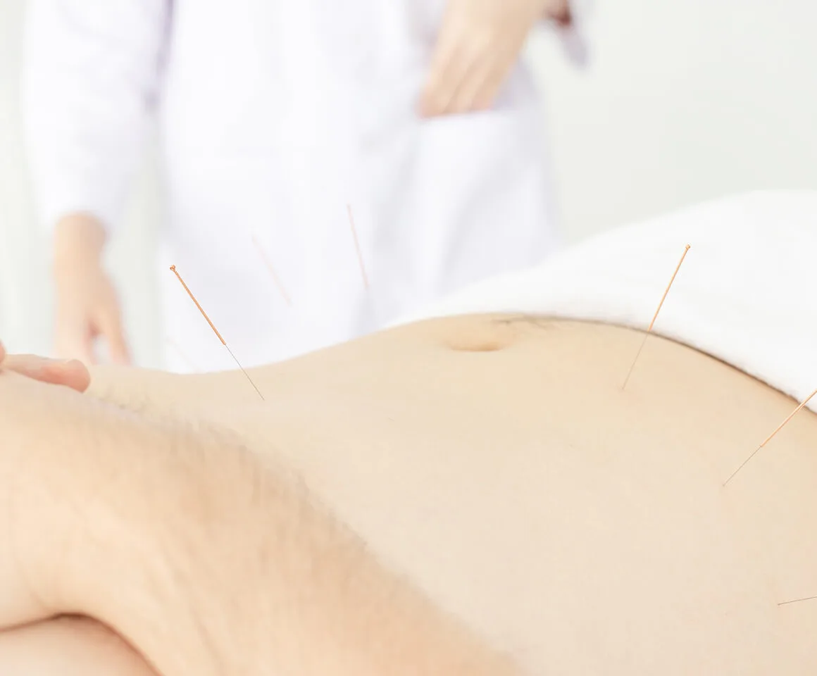How Acupuncture supports weight loss