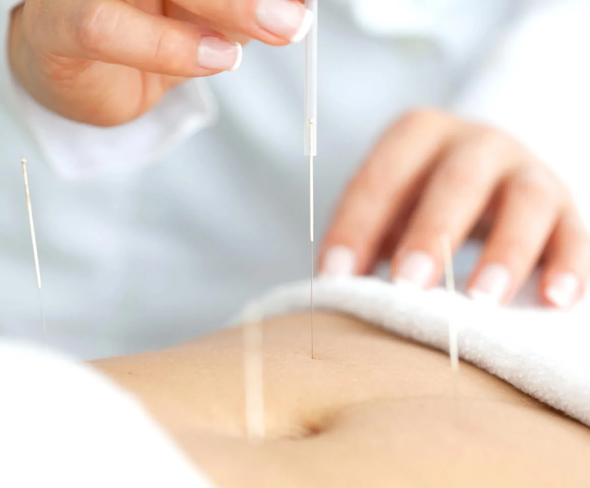 Acupuncture for Women’s Health